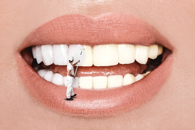Comment faire pour avoir des dents blanches ?