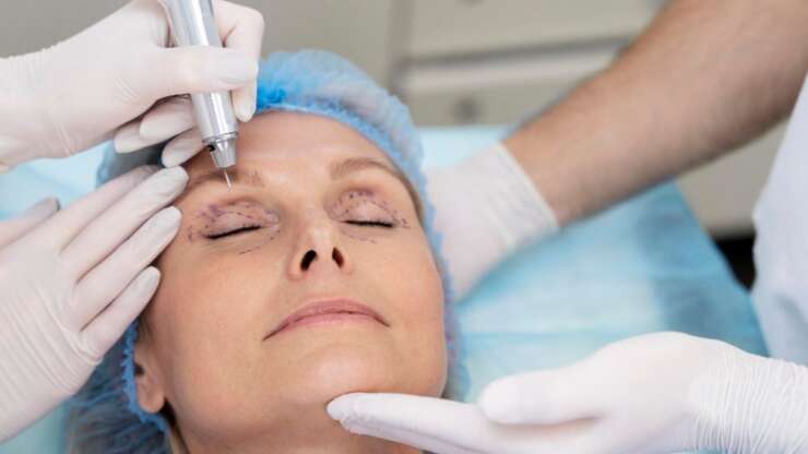Blépharoplastie laser en Tunisie : le meilleur prix pour rajeunir le regard