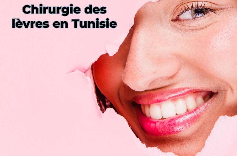 Chirurgie des levres en Tunisie pour des lèvres magnifiquement remodelées